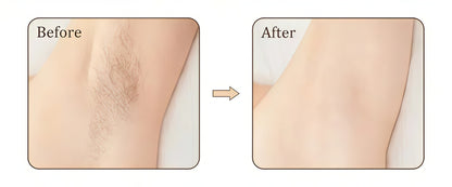 Painless IPL Hair Remover – Ice Cooling System with Replaceable Heads